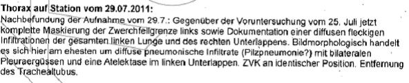 Thorax 29.07.2011 Agnes Karll Krankenhaus Laatzen