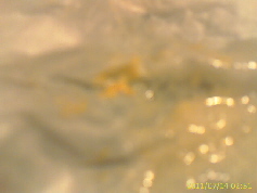 KLARES SPUTUM MIT ORTHOMOL UND SONDENKOST